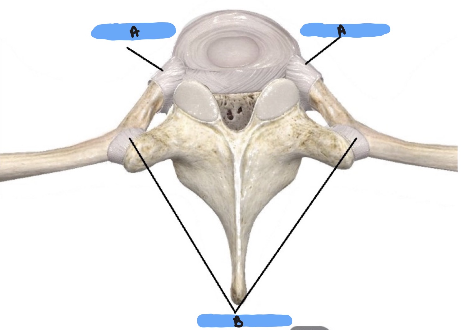 <p>NTK</p>