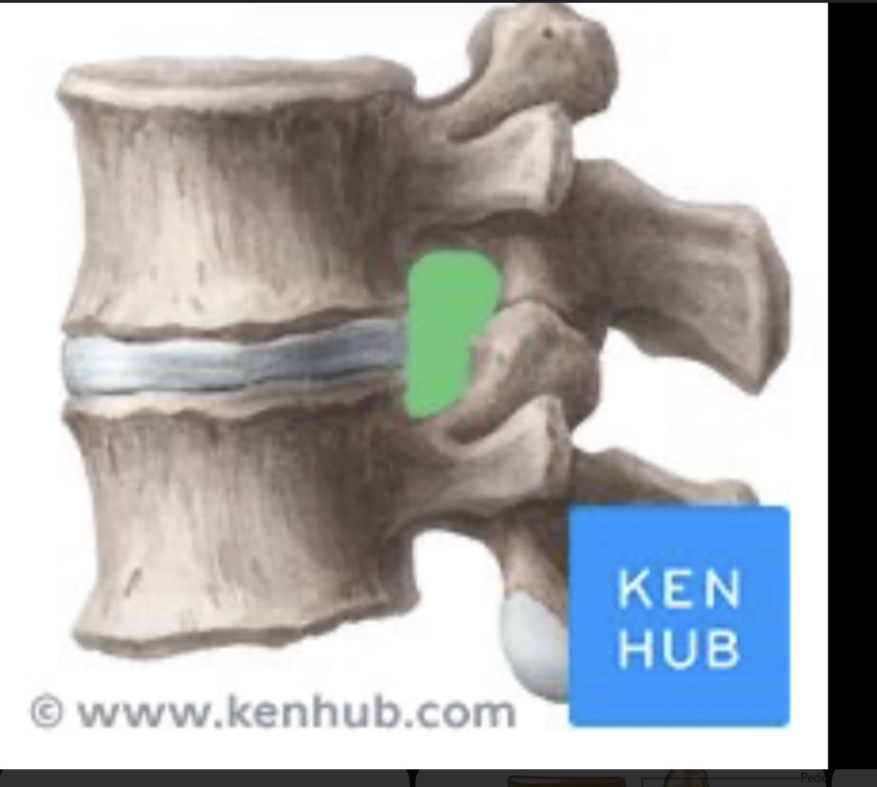 <p>Hole 2 vertebrae </p>