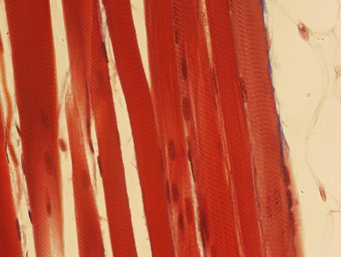 <p>Identify the type of muscle tissue shown?</p>