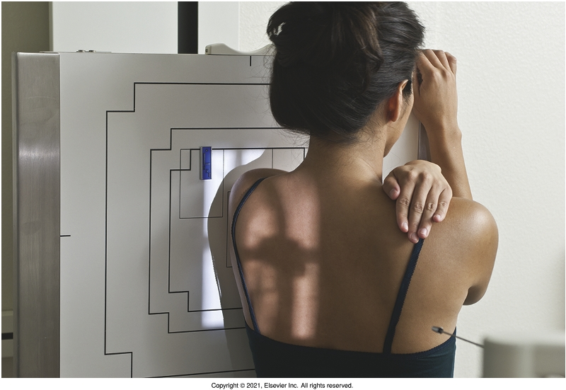 <p>stand facing the erect bucky/oblique as needed (30°) with the anterior of the side of interest closest to the detector, fix elbow to 90° and place hand across the front of the body, epicondyles should be superimposed, adduct the arm so the humeral shaft is anterior to the body, bring tightly across the front of the patient’s body</p>
