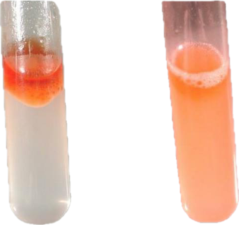 <p>In the Sudan IV Test, if it was negative, what does the color change/stay to?</p>
