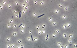 <p>endospores will be clear! </p>