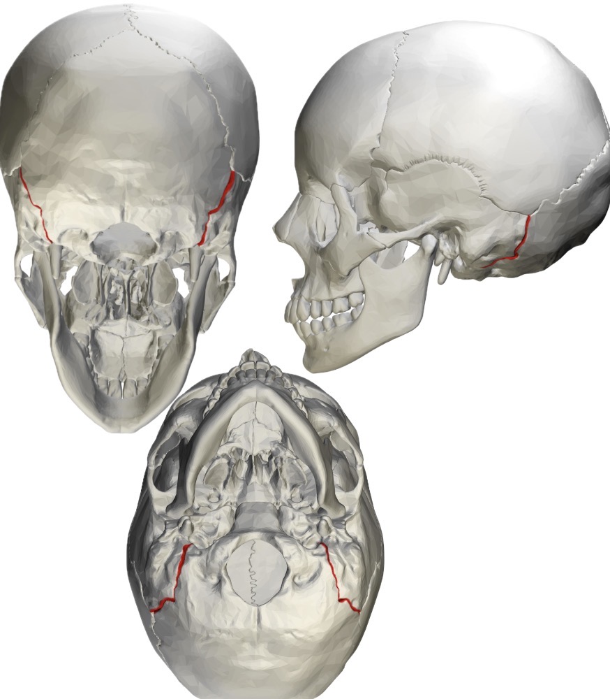 <p>what bone is this?</p><p></p>