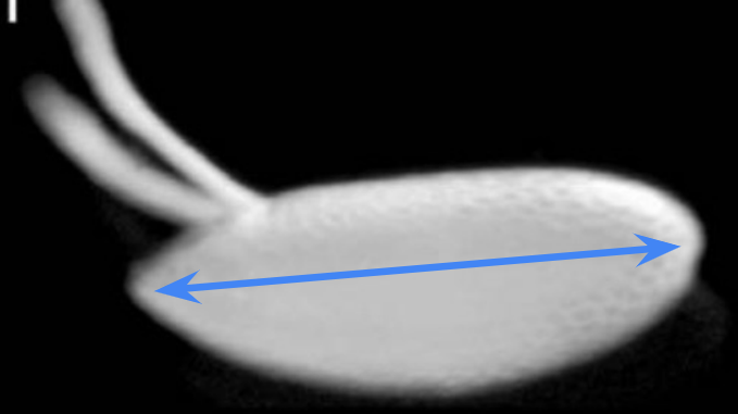 <p>The anterior-posterior axis</p>