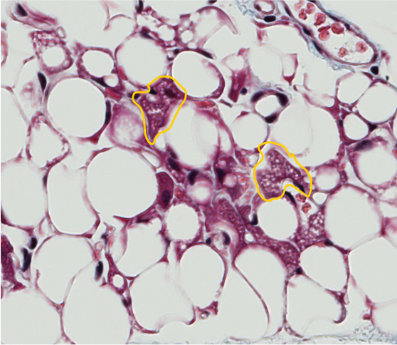 <p><span style="font-family: "Calibri Light";">1. Brown adipose tissue cells are encircled. <br><br>2. White adipose cells are unilocular (one large lipid vacuole per cell). How do brown adipose cells differ?</span></p>