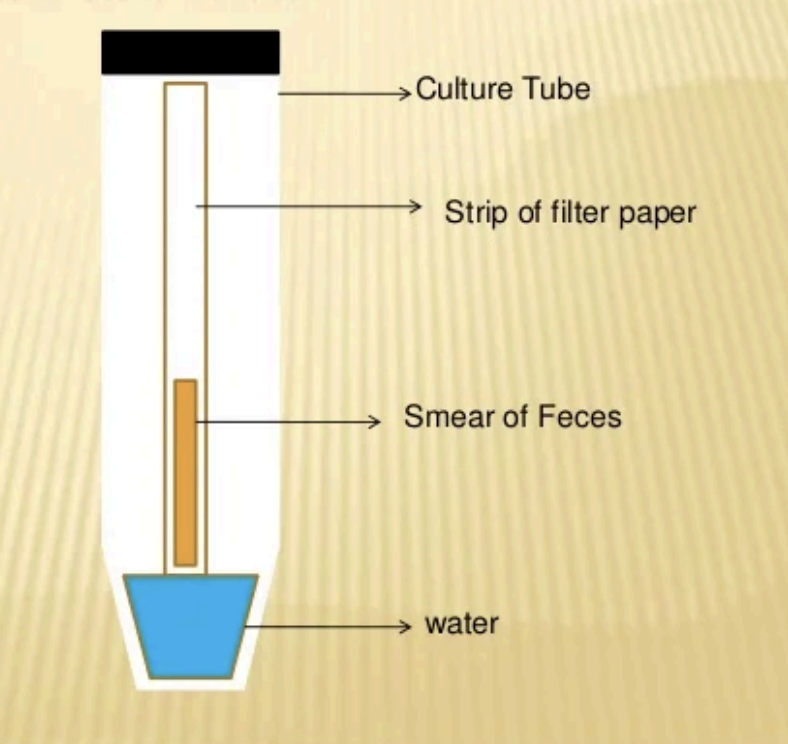 <p>stool culture technique</p>