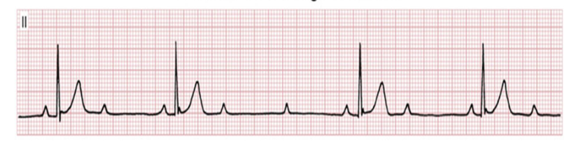 <p>what is this </p>