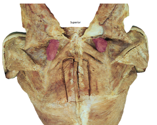 <p>What’s the name of this muscle, and its OIAN</p>