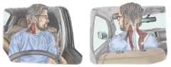 <p>· Ipsilateral Neck Rotation</p><p> ipsilateral neck rotation for activities like looking out the window while driving</p><p>· Contralateral Neck Rotation</p><p> contralateral neck rotation for activities like driving</p>