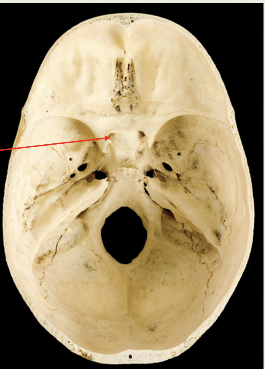 <p>Optic Nerve</p><p>(II)</p><p>■ Function: XX</p><p>(XX)</p><p>■ Passes through the</p><p>XX XX</p><p></p>