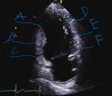 <p>What segment is at E? </p>