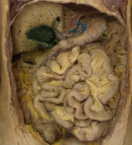 term image