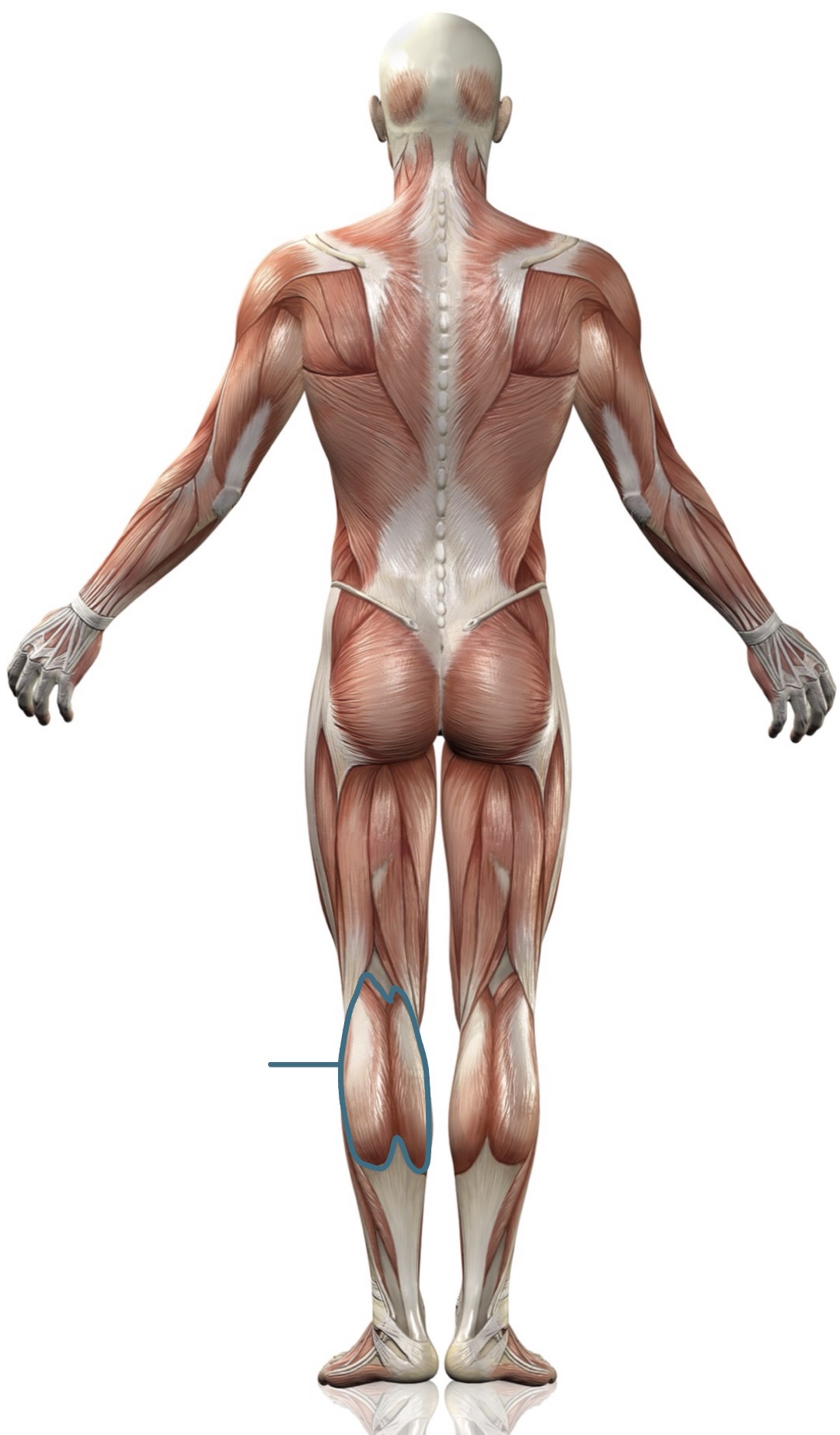 <p><strong>Name the following muscle</strong></p>