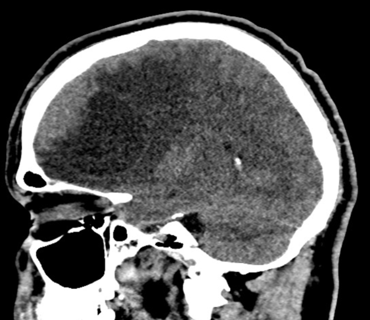 <p>Name the pathology </p>