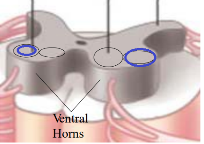 <p>describe the lateral motor nuclei</p>