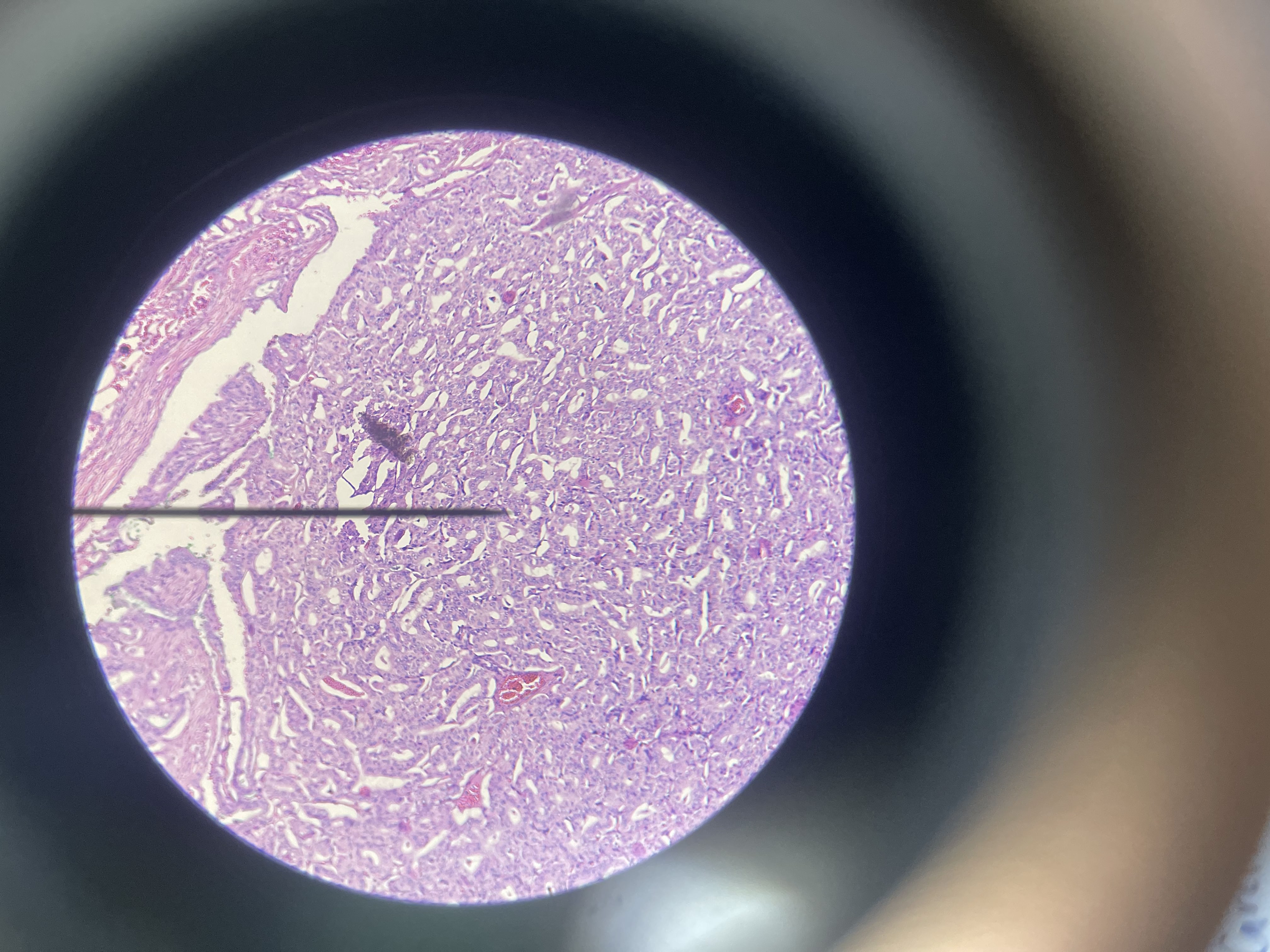 <p>What is the diagnosis?</p>