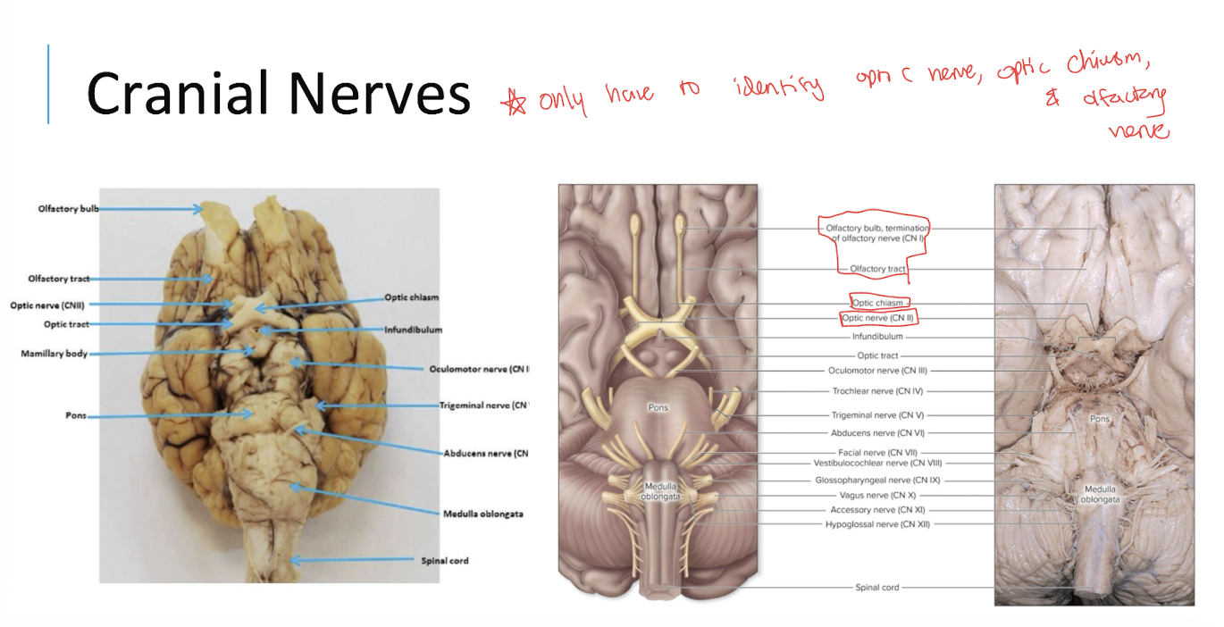 <p>The optic nerve (II) and the visual pathway.</p>