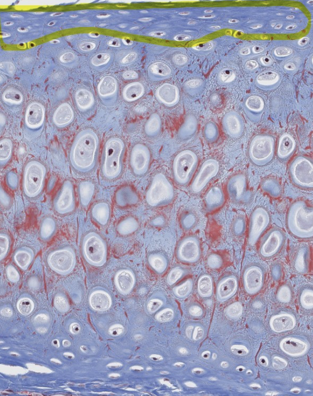 <p>What do we call the CT capsule that surrounds hyaline and elastic cartilage?</p>