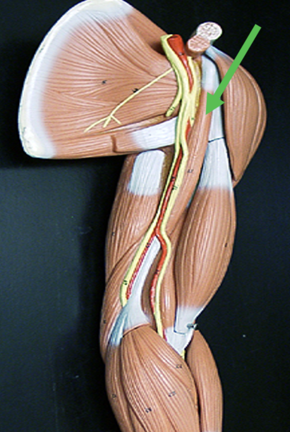 <p>Identify the muscle indicated by the pointer.</p>