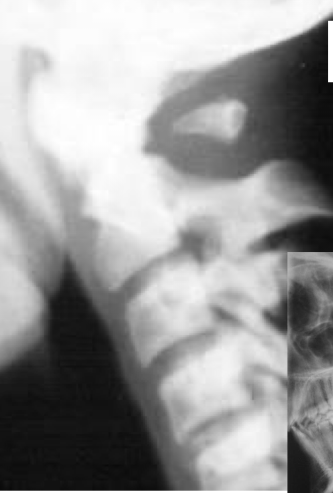 <p>What is the Dx</p>