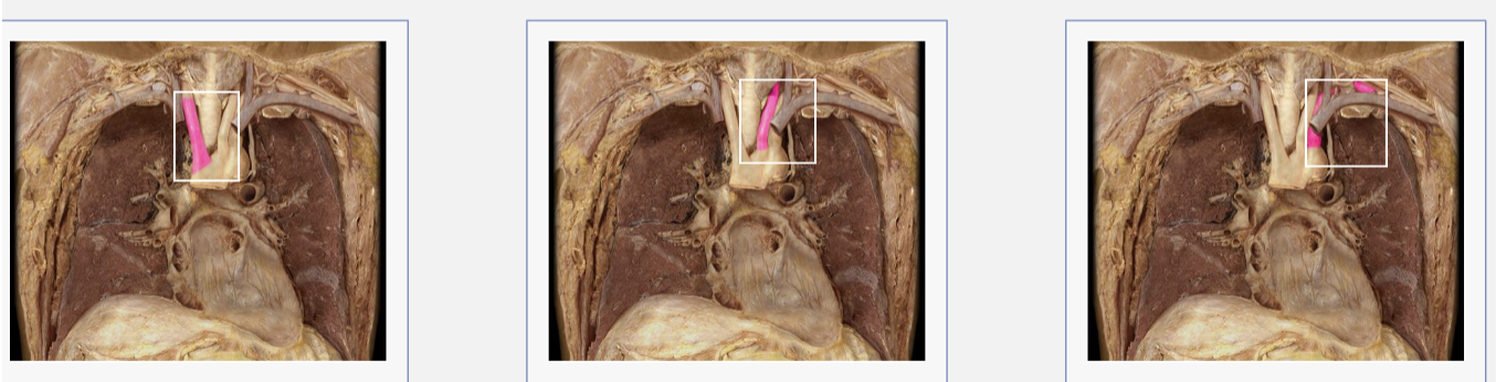 <p>brachiocephalic trunk, left common carotid artery, left subclavian </p>