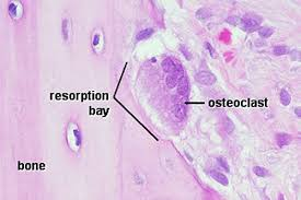 <ul><li><p>large multinucleated cells</p></li><li><p>from precursor cells in blood</p></li><li><p>resorbs bone</p></li></ul><p></p>
