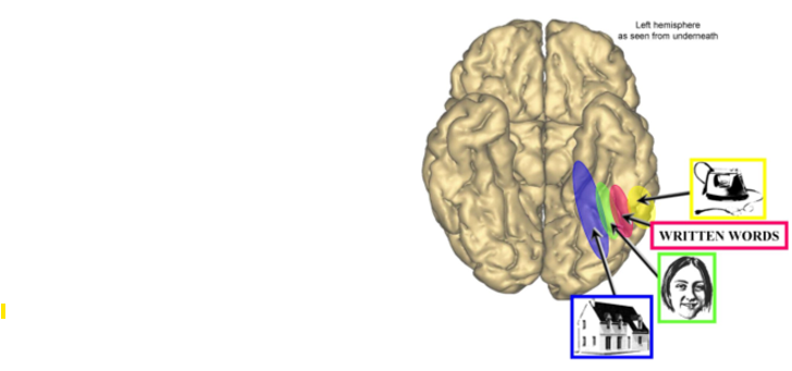 <p>Visual Word Form Area; a region in the occipital-temporal sulcus selectively activated for word recognition.</p>