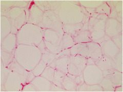 <p>Connective tissue. Scattered cells, little matrix, used for insulation and energy storage</p>