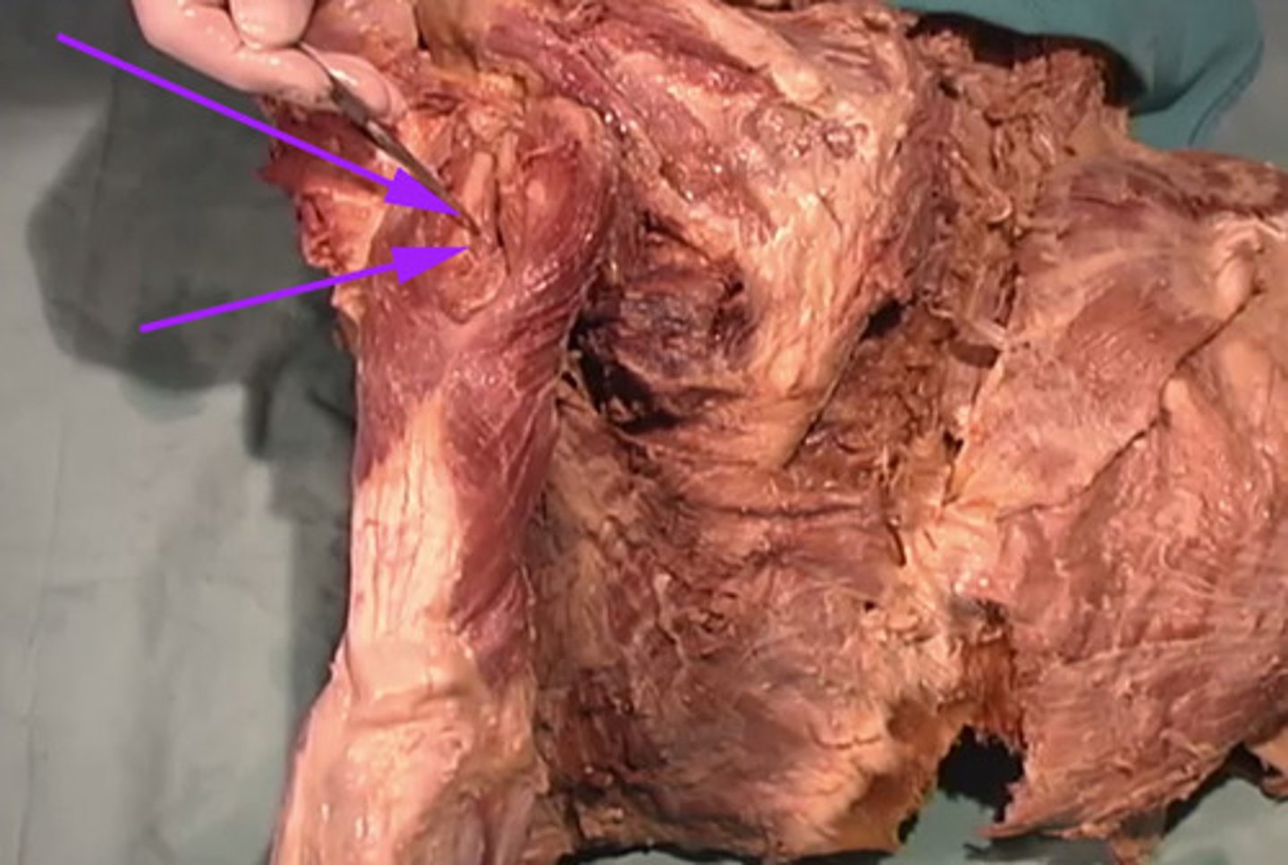 <p>What is the name of this muscle as indicated by the arrow</p>
