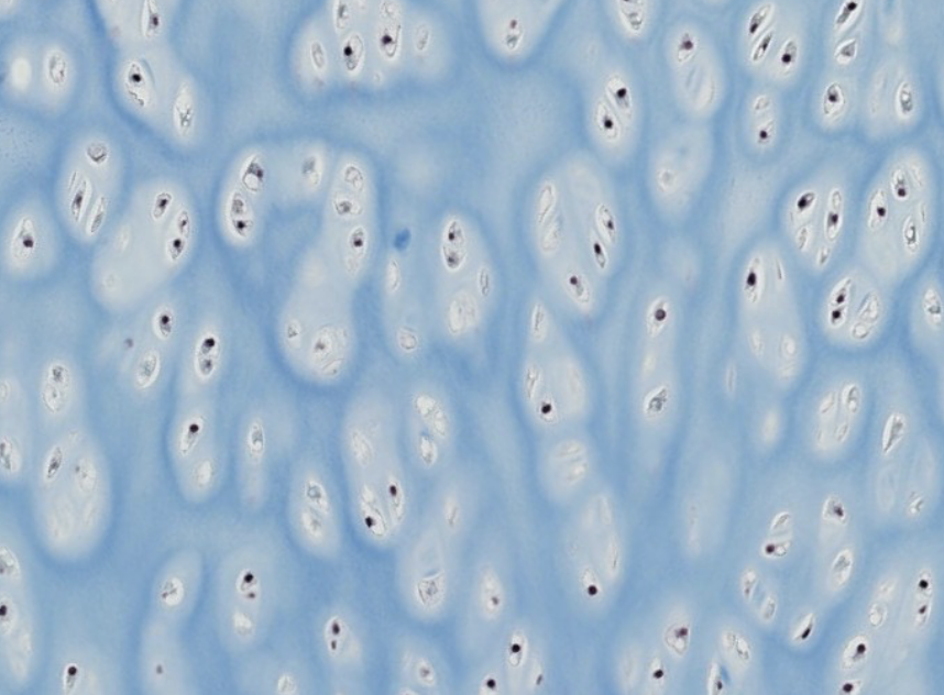 <p>which type of CT is this?</p>