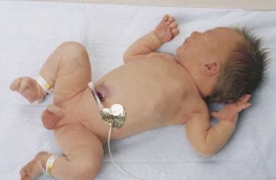 <ul><li><p>hold their arms close to the body with elbows sharply flexed </p></li></ul><p></p>