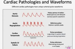 <p>-aortic stensosis: pulsus parvus </p><p>-aortic regurg: bisferiens pulse</p><p>-cardiac tamponade: pulsus paradoxus </p><p>-systolic LV failure: pulsus alternans </p><p>đź’ˇenjoy photo from the google</p>