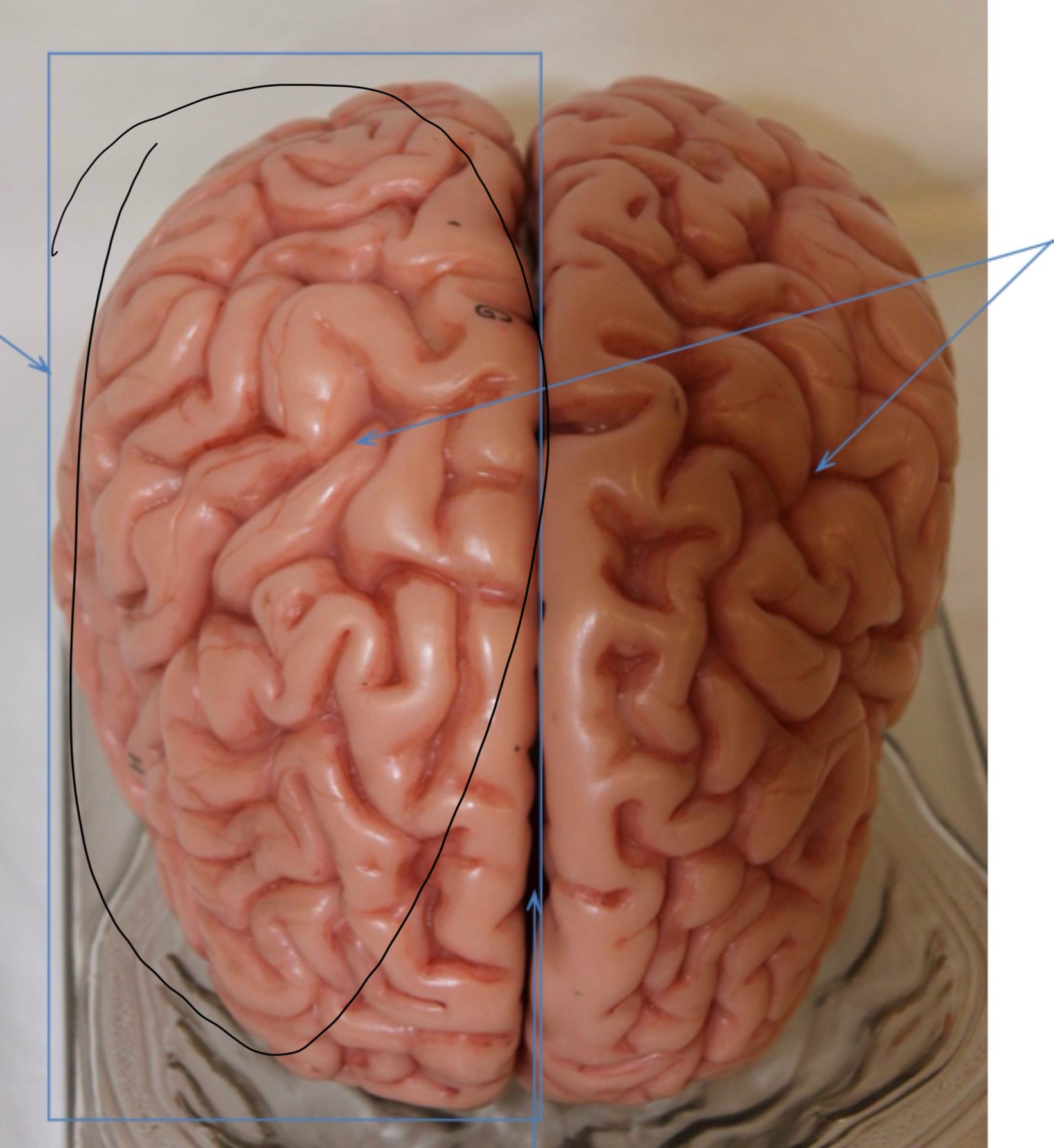 <p>Identify the circled area?</p>