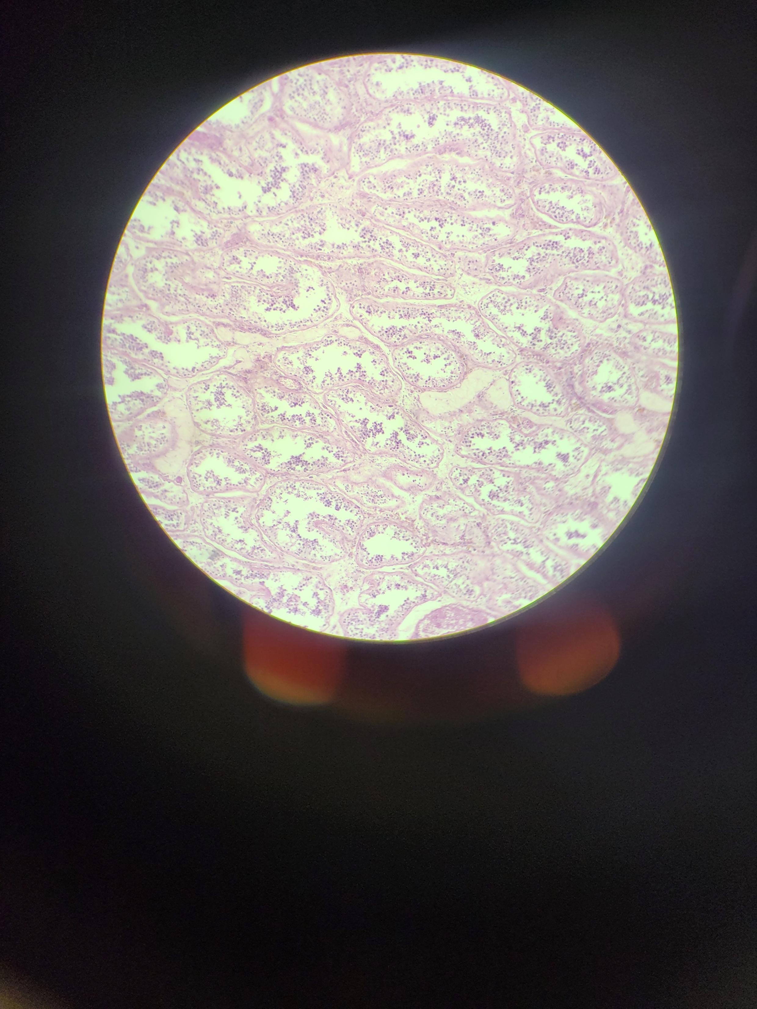 <p>What tissue is this? What is its function</p>