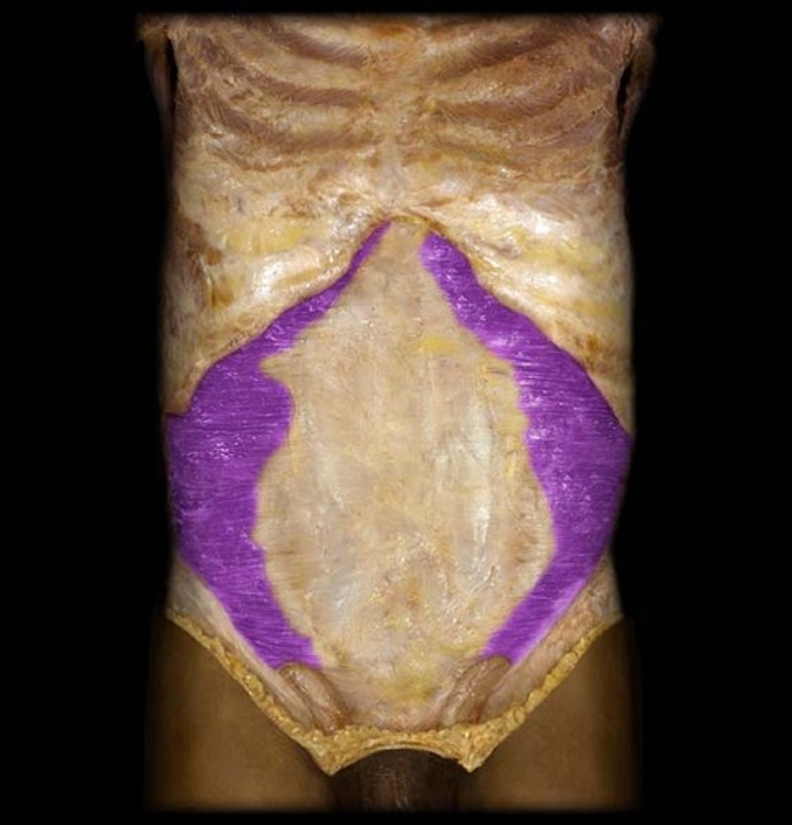 <p>Thoracolumbar fascia; medial lip of iliac crest, lateral 1/3 of inguinal ligament; costal cartilages of inferior six ribs (7-12)</p>
