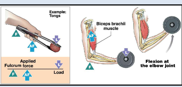 <ul><li><p>Third-class lever ( L - AF - F)</p><ul><li><p>Most common <strong>lever</strong> in body.</p></li><li><p><strong>Speed</strong> and distance are increased at expense of <strong>force</strong>.</p></li></ul></li></ul><p></p>