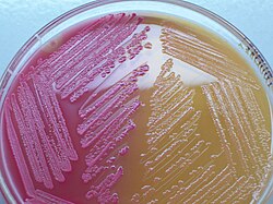 <p>What is the observation and Conclusion of this agar plate? (left vs right)</p>