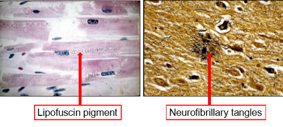 <p>Lipofuscin pigment (cellular debris) and neurofibrillary tangles</p><ul><li><p>In heart & neurons → they don’t divide (non-mitotic)</p></li></ul><p></p>
