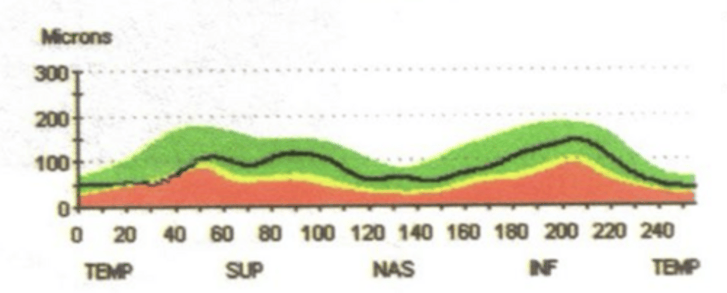<p>Where is the thinning in this TSNIT curve?</p>