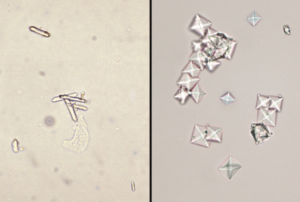 <p>What type of crystal is this? (left)</p>