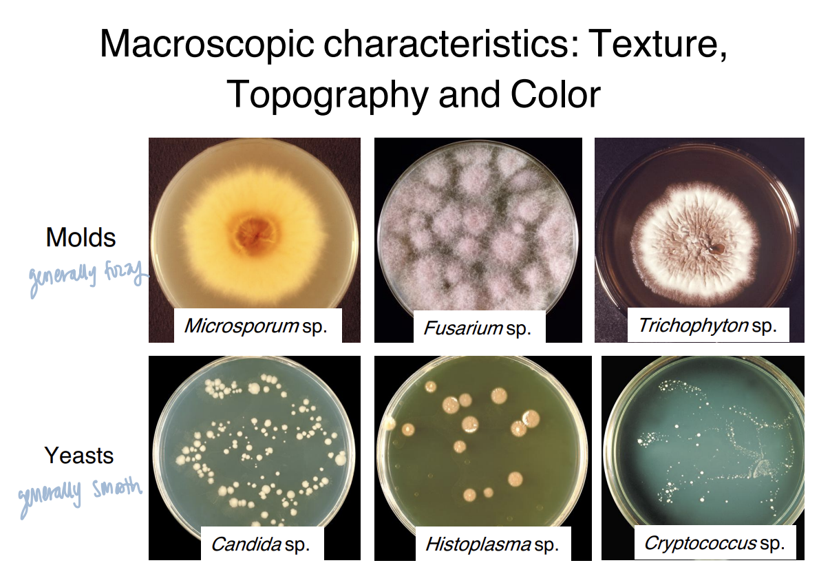 <p><strong>Fungal colonies can be characterized macroscopically by their texture, topography, and color.</strong></p><p><span data-name="mag_right" data-type="emoji">🔎</span> <strong>What this means:</strong></p><p>These are characteristics you can observe at the <strong>colony level</strong>, rather than by examining individual fungal structures under a microscope.</p><p><span data-name="bulb" data-type="emoji">💡</span> <strong>Macroscopic = texture + topography + color.</strong></p>