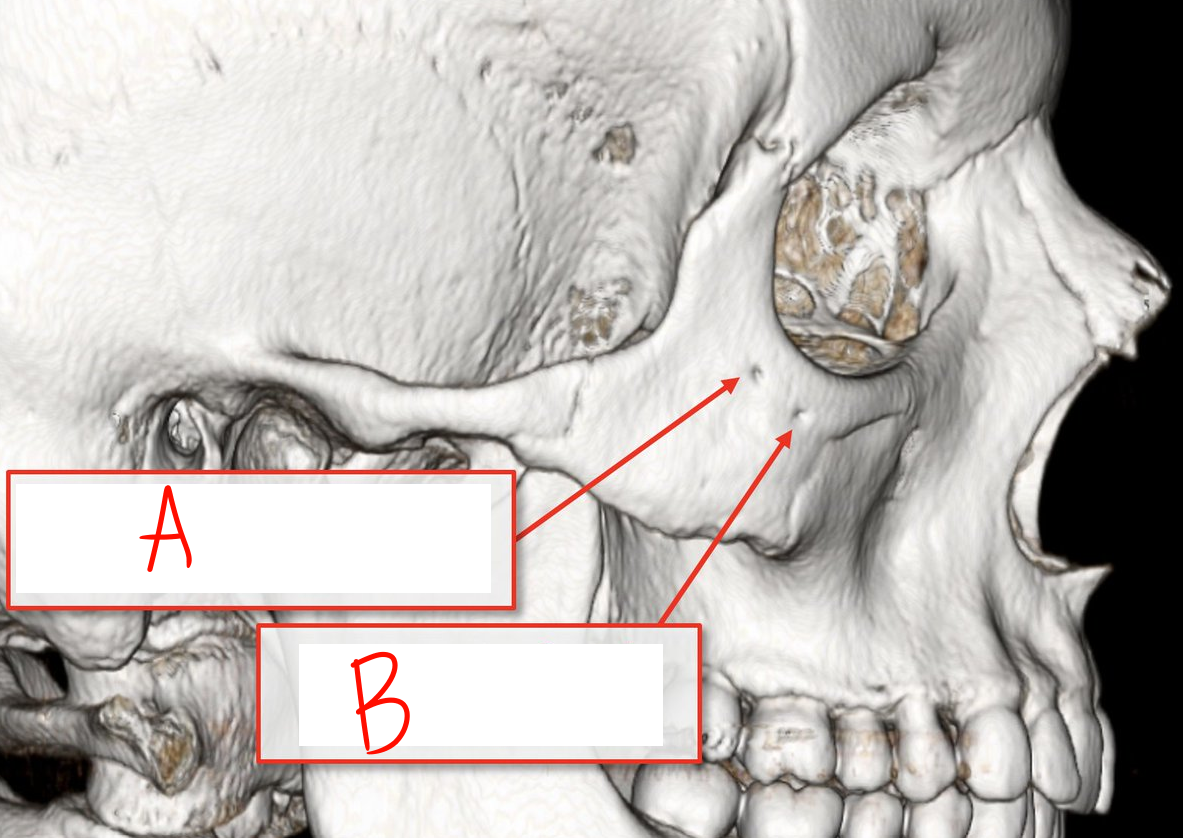 <p>Identify bony marking A</p>