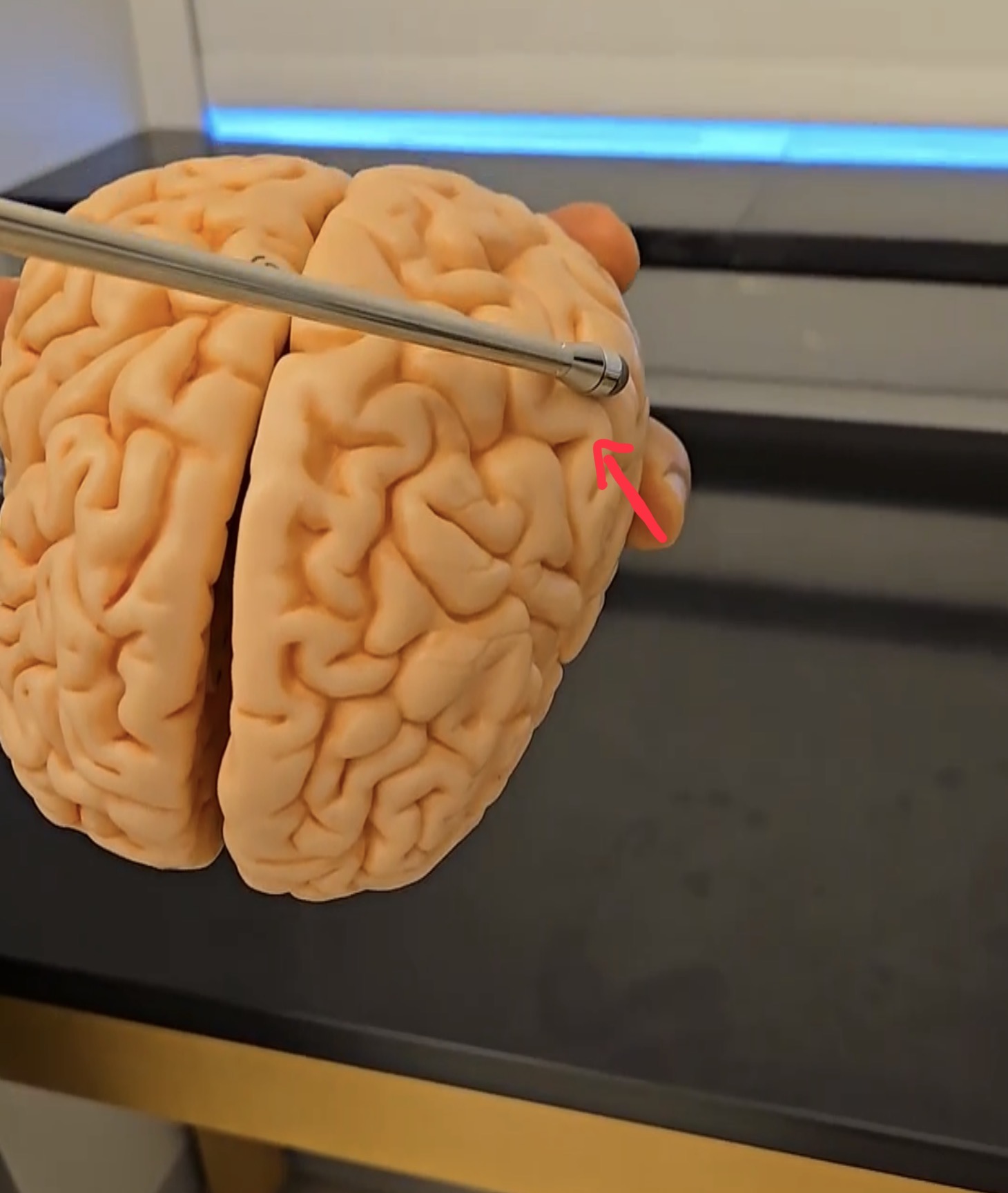 <p>Left cerebral hemisphere.</p>