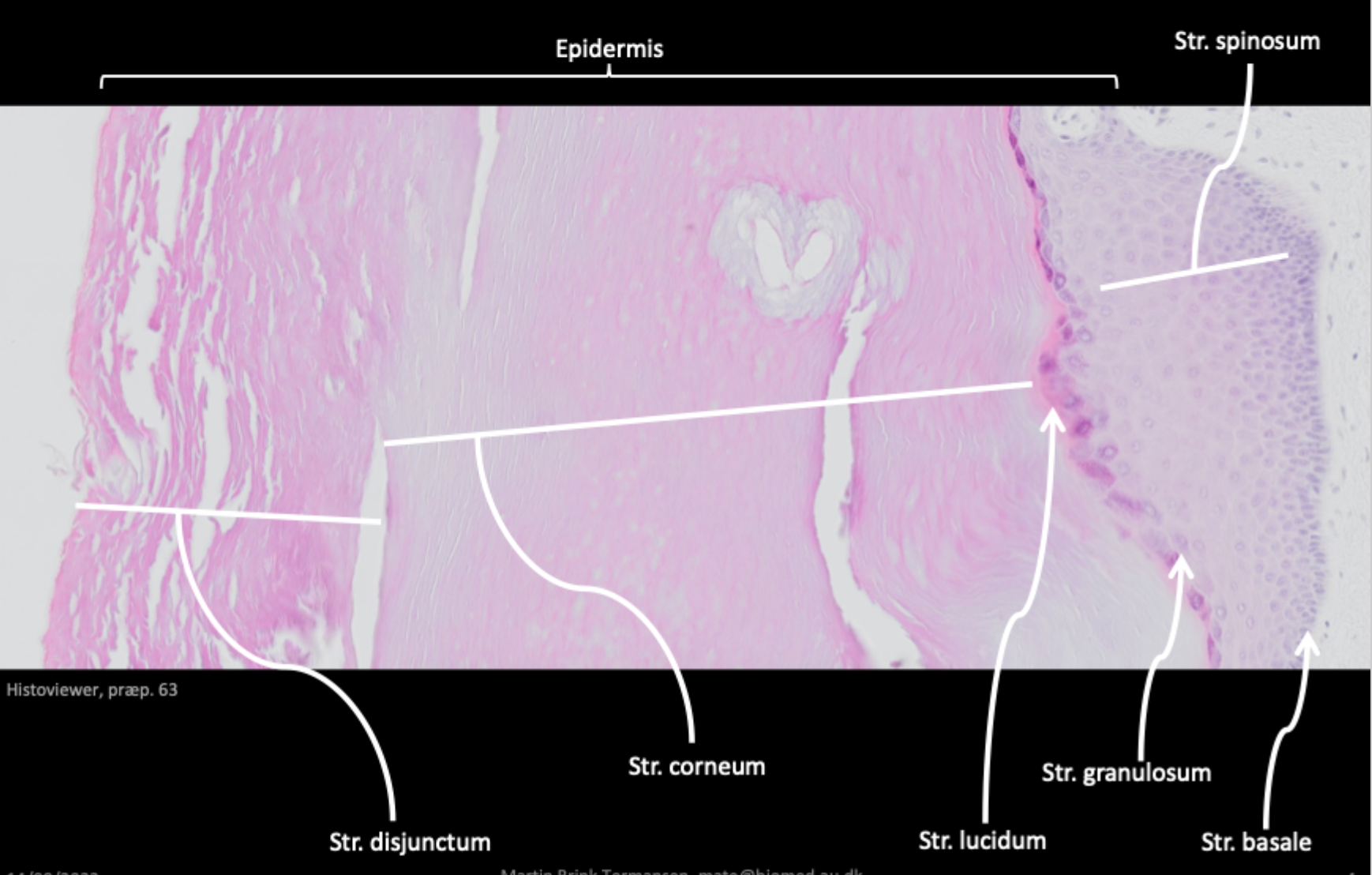 <p>Stratum… Basale → spinosum → granulosum → lucidum → corneum → disjunctium<br>““Børn Spiser Gerne Lækre Chokolade Donuts”"</p>