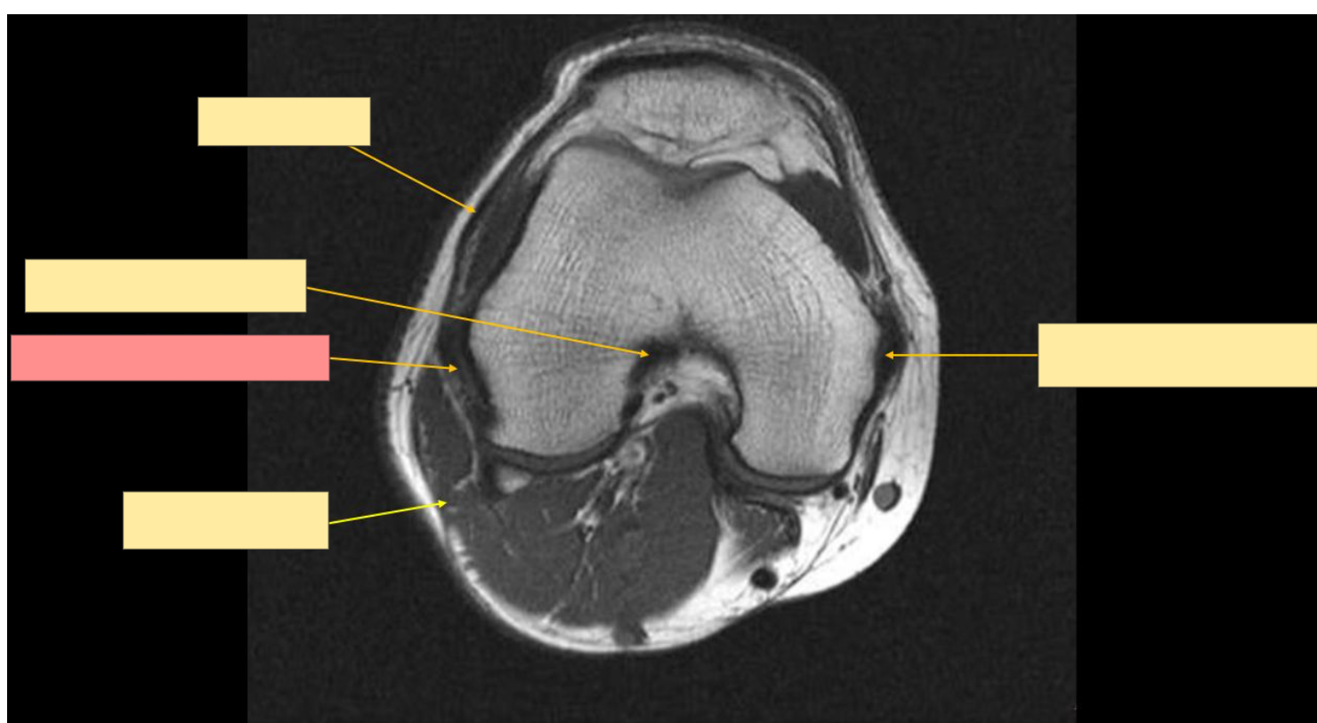 <p>Identify the structure</p>