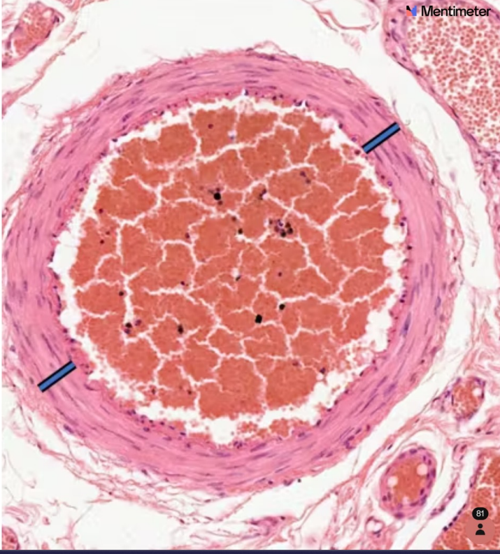 <p>Identify the layer indicated by the line</p>