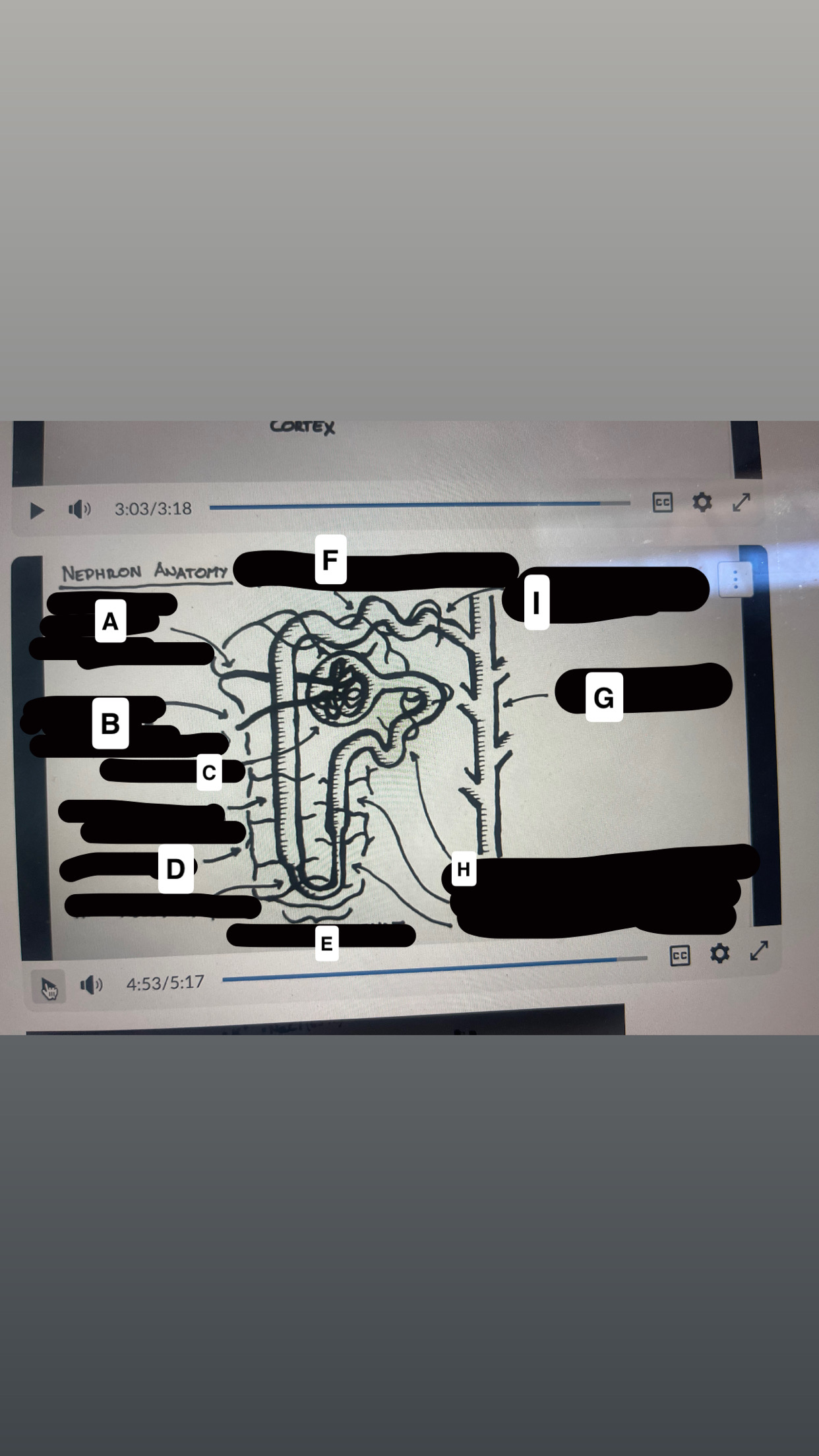 <p>identify letters F, A, C, D, I, G, E, H, B</p>