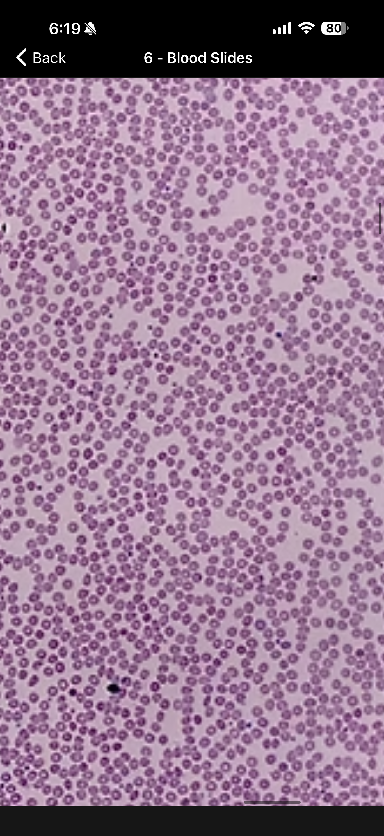 <p><span>red blood cells; mature blood cells that are mostly composed of hemoglobin and functions primarily in the transportation of oxygen and carbon dioxide</span></p>