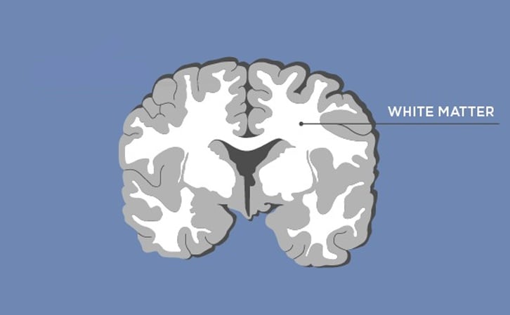 <p>white matter</p>