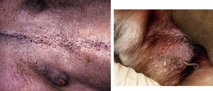 <ul><li><p><strong>secondary lesion</strong></p></li><li><p>plugged follicle with keratin &amp; sebum</p></li><li><p>ex. endocrine dermatoses (hyperadrenocorticism); pressure points</p></li></ul><p></p>